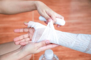 Anaheim Burn Injury Lawyer